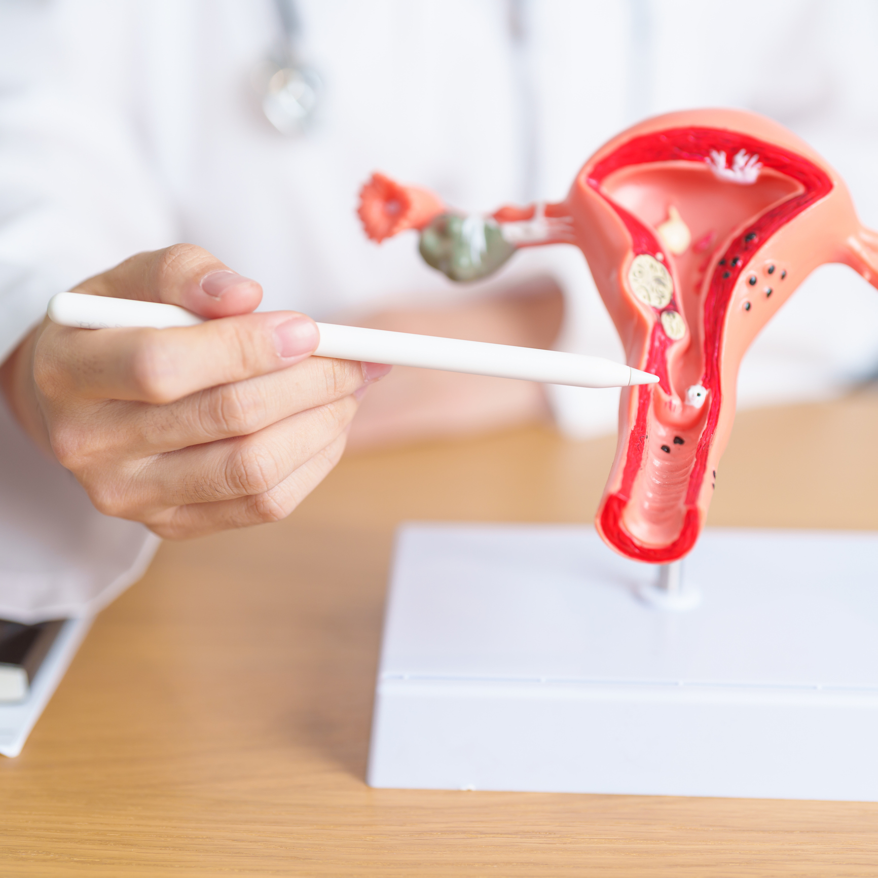 Medical professional with uterus anatomy model