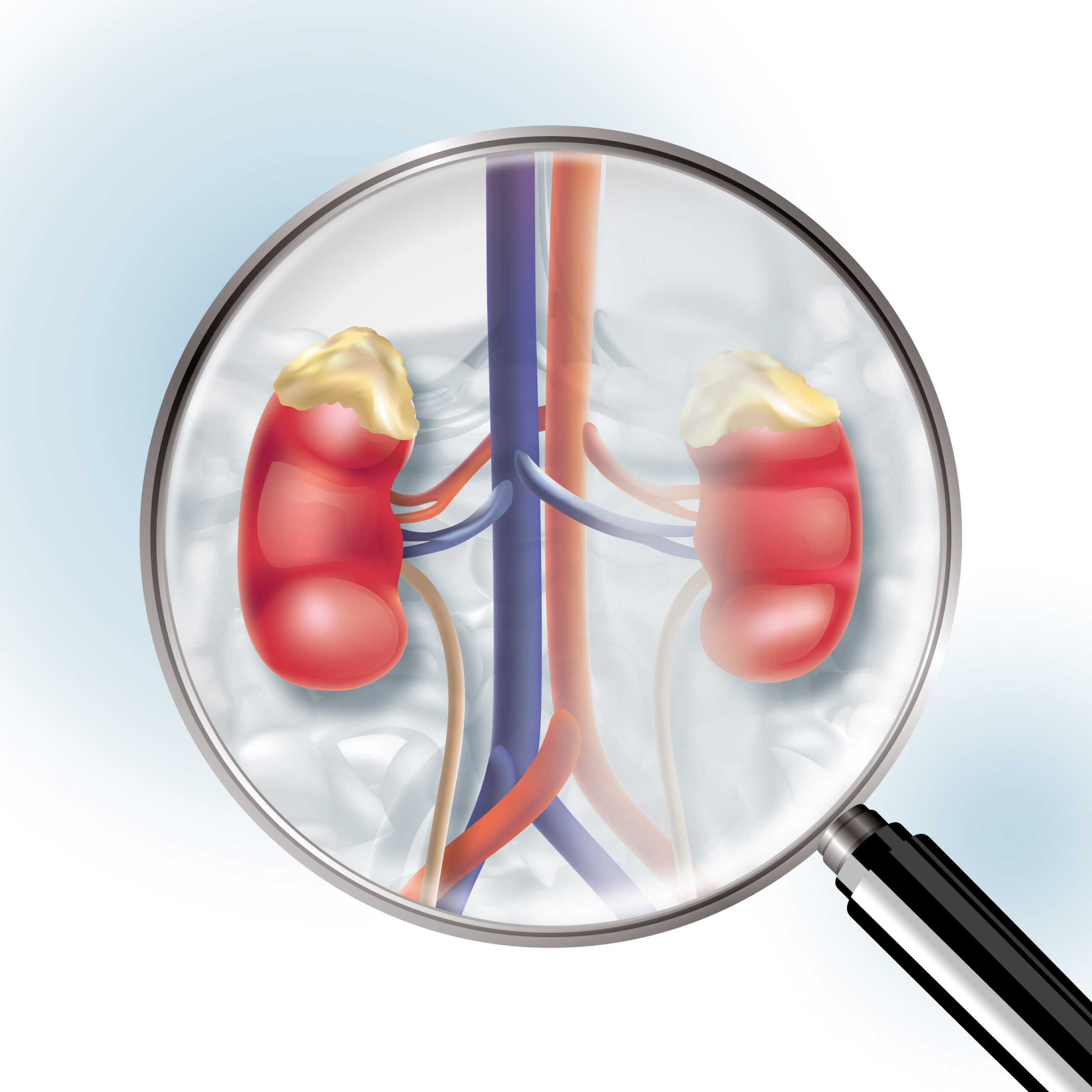 Kidneys and veins depicted with magnifier