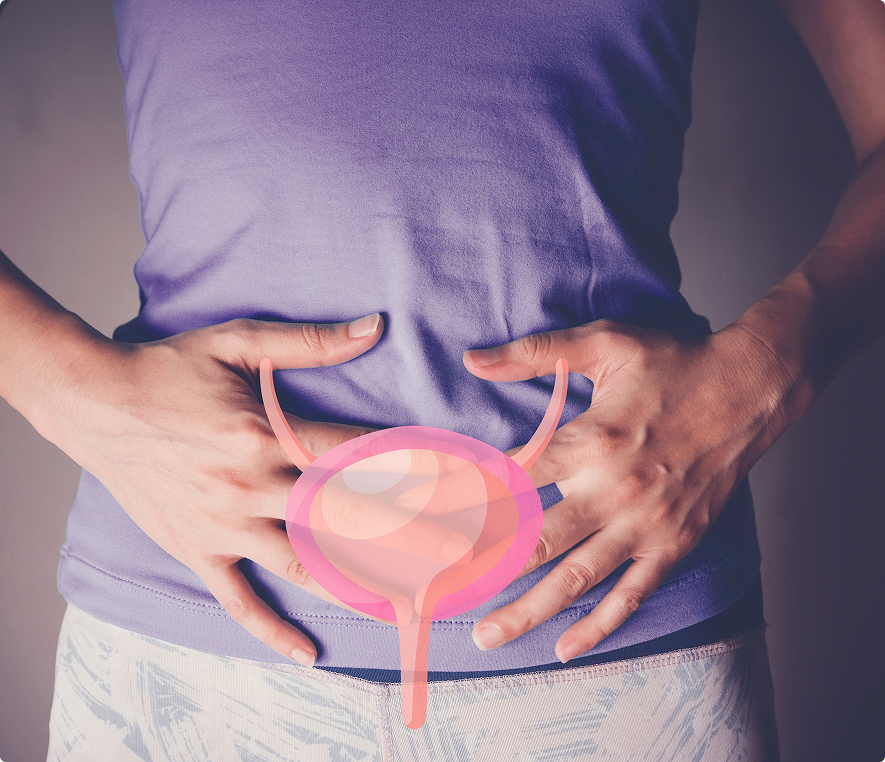 Woman with bladder pain illustration