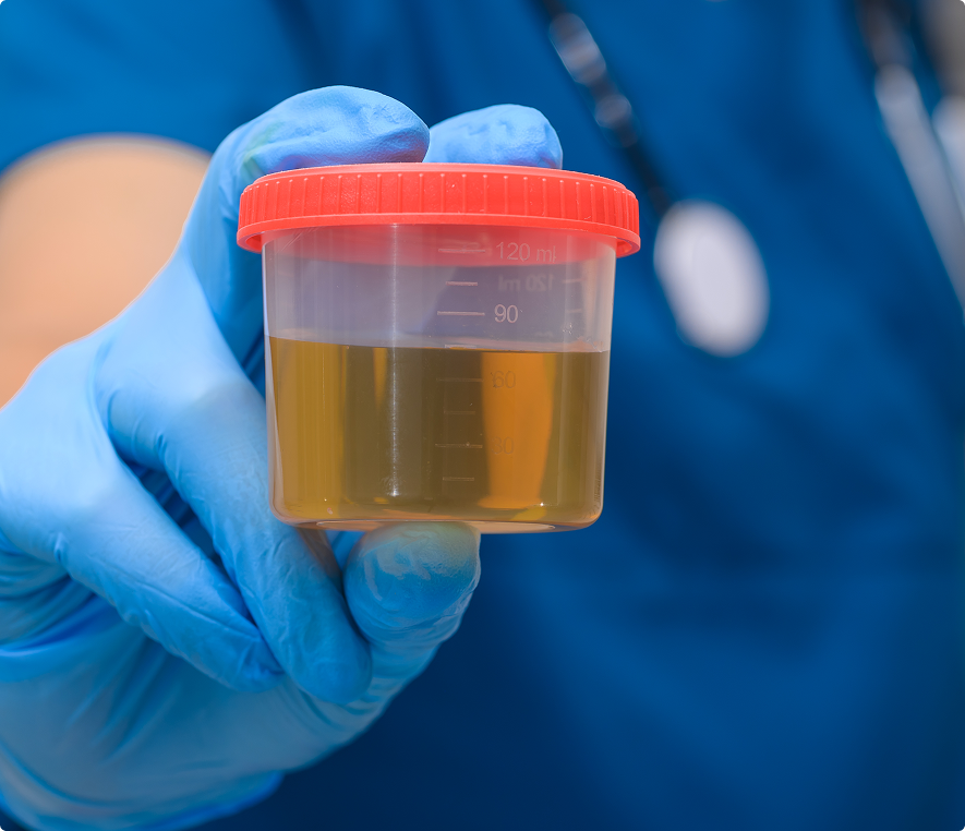 Medical professional holding urine sample
