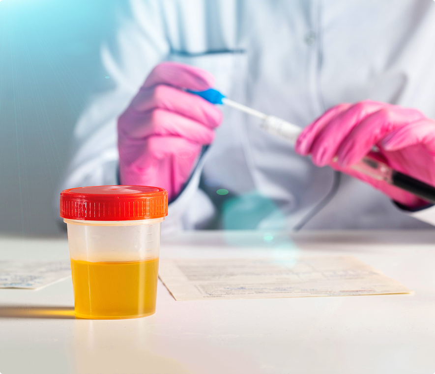 Urine sample with lab technician