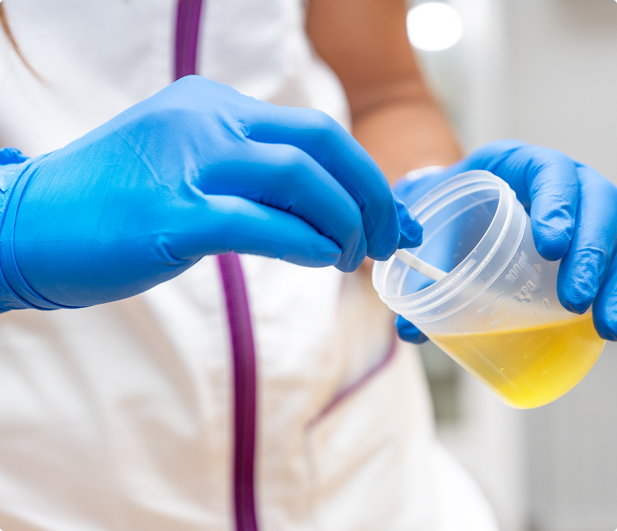 Urine test in progress with gloves