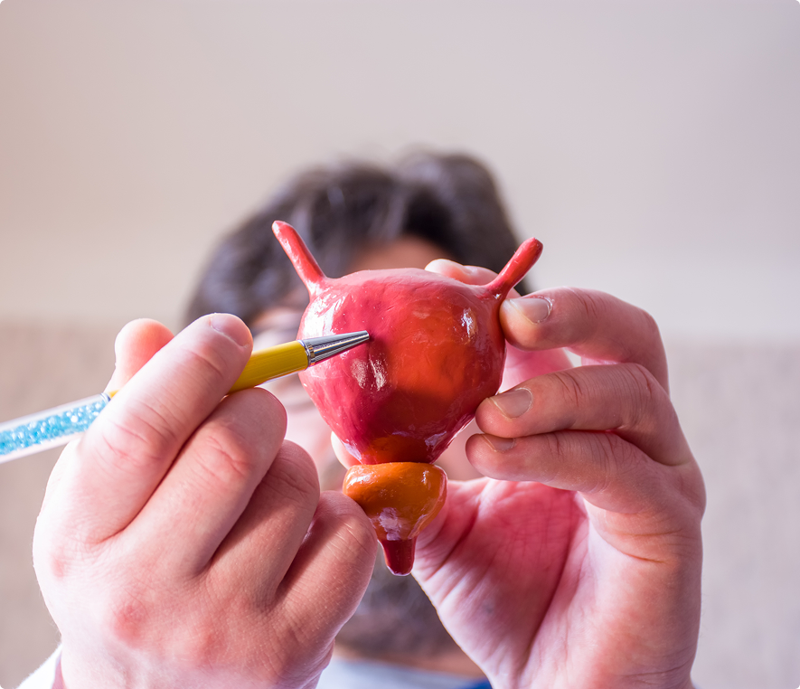 Hands examining anatomical bladder model