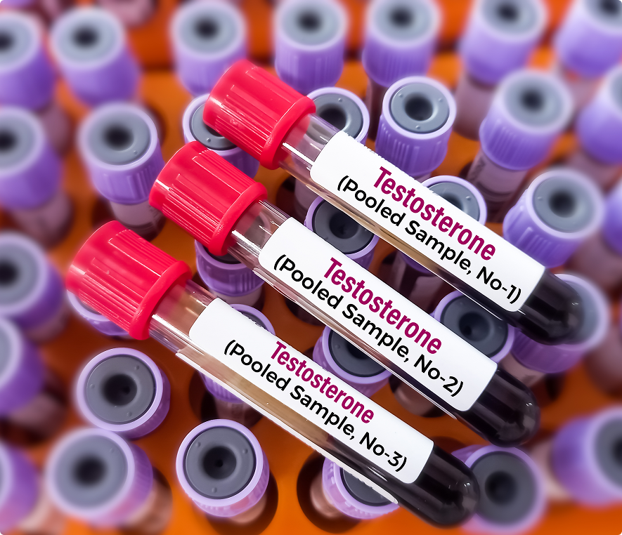 Blood samples labeled testosterone