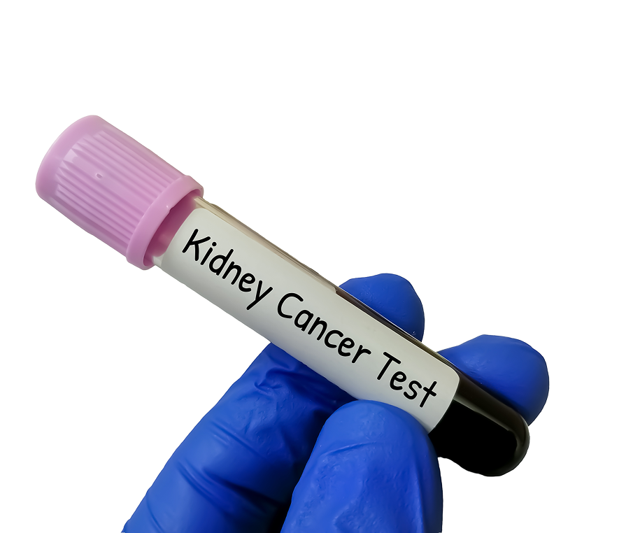 Gloved hand holding cancer test tube