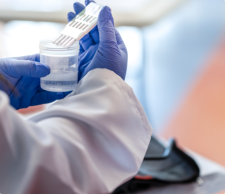 Lab technician holding urine test strips