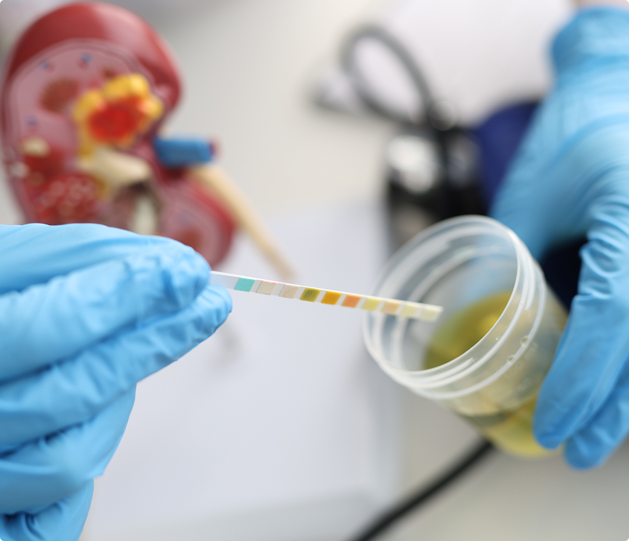 Gloved hands holding a urine test strip.