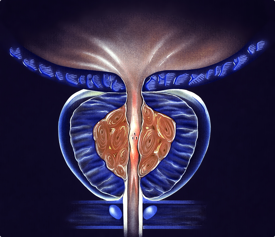 Cross-section of prostate gland