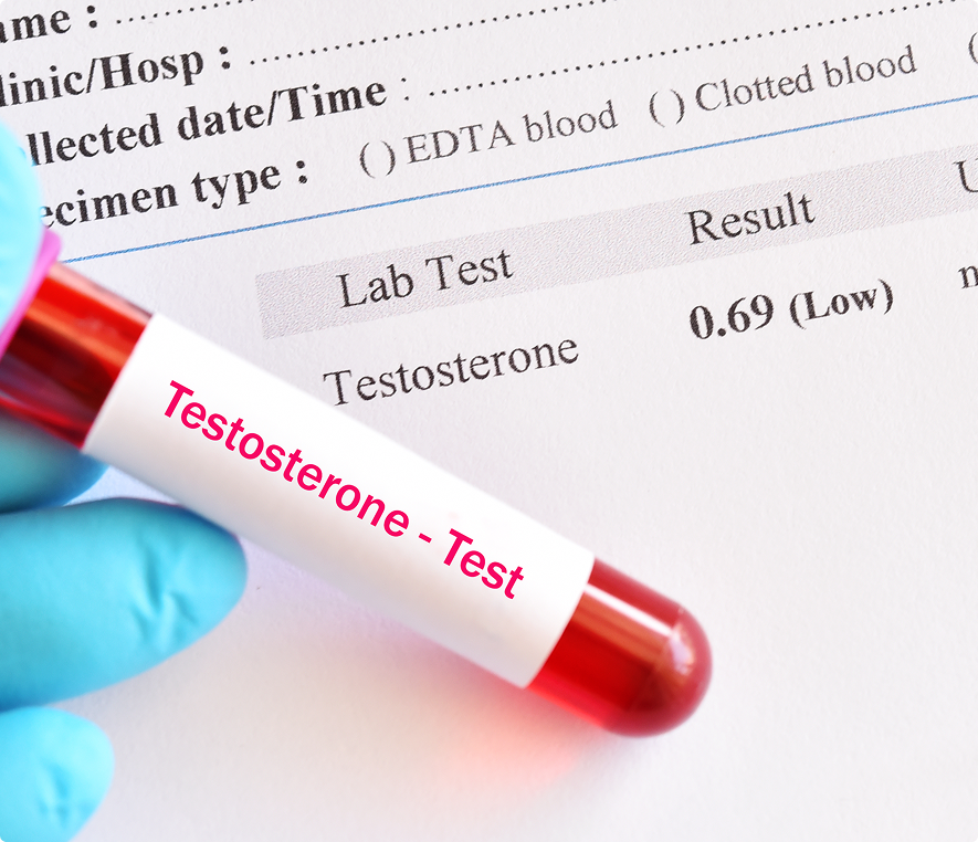 Blood sample for testosterone level analysis