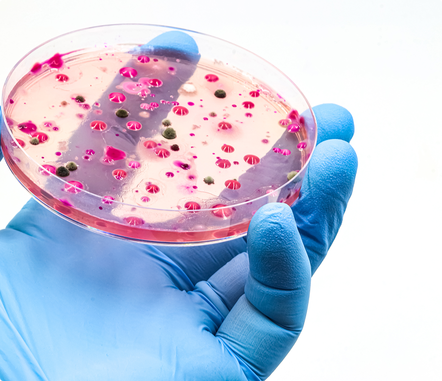 Bacterial colonies in petri dish