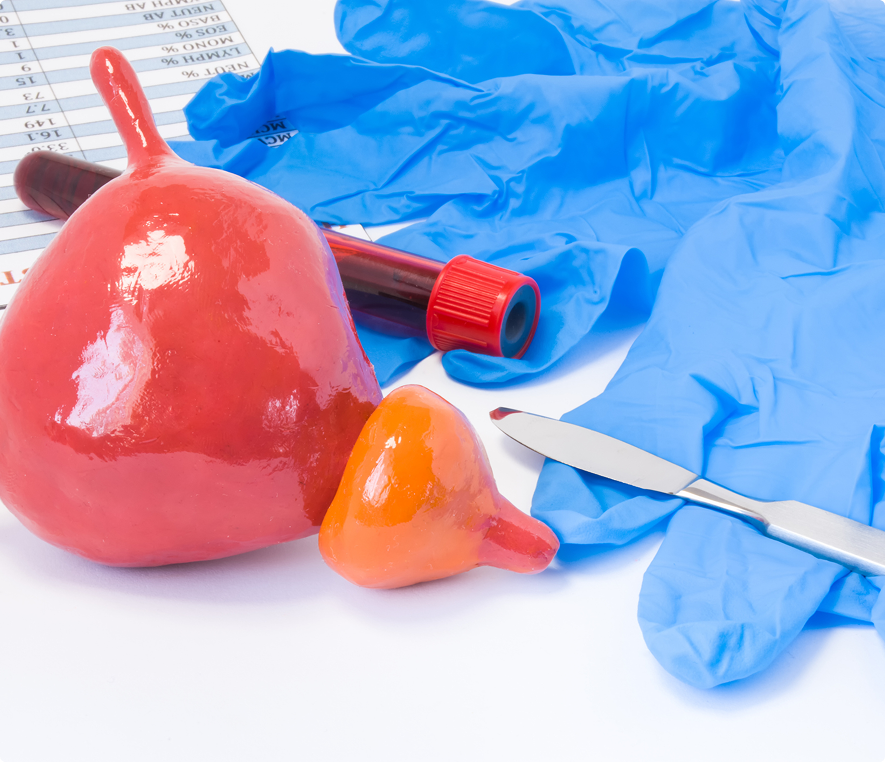 Medical tools and prostate model on table