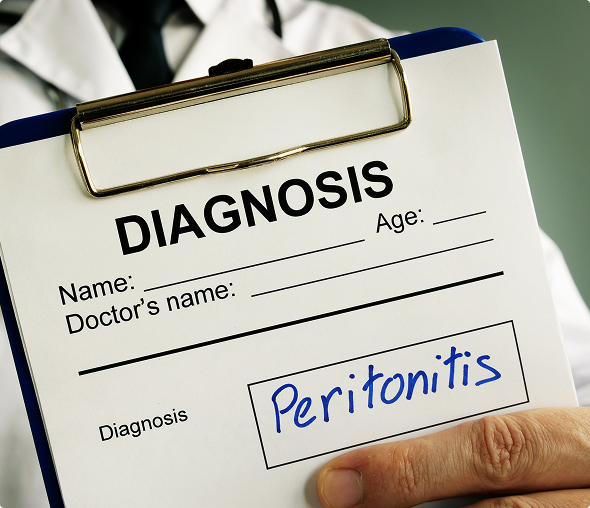 Diagnosis form showing peritonitis