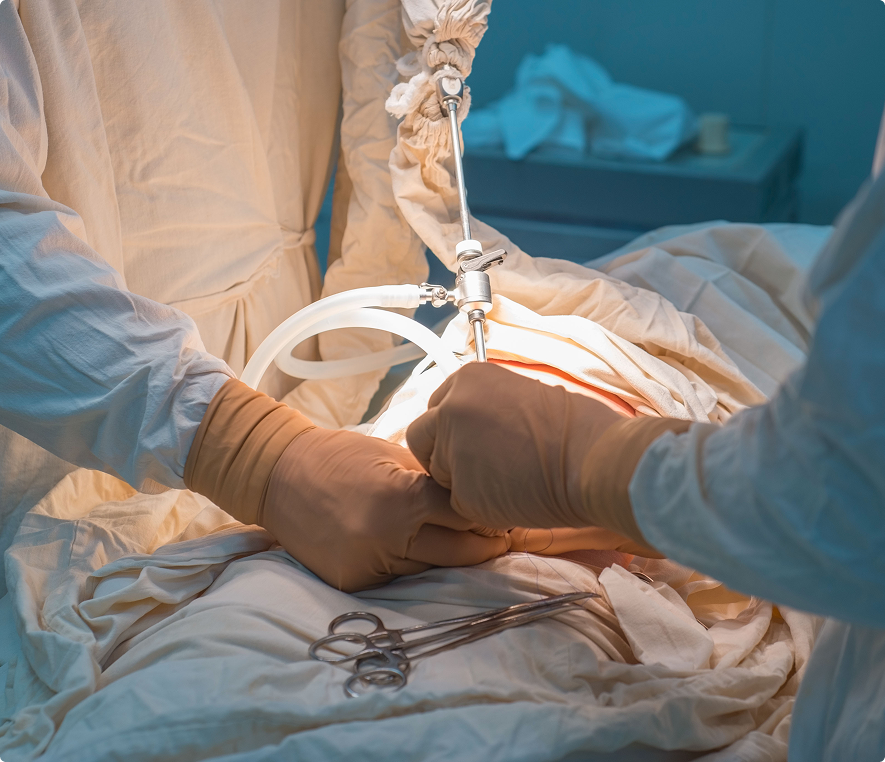 Surgical procedure with medical instruments