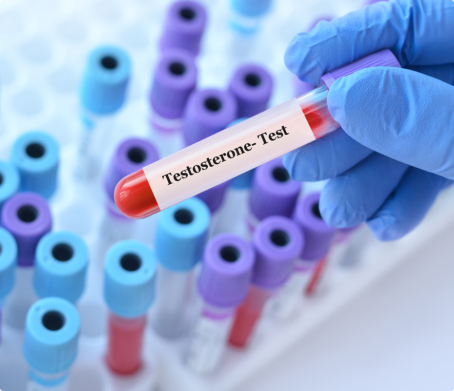 Laboratory test tubes with blood sample