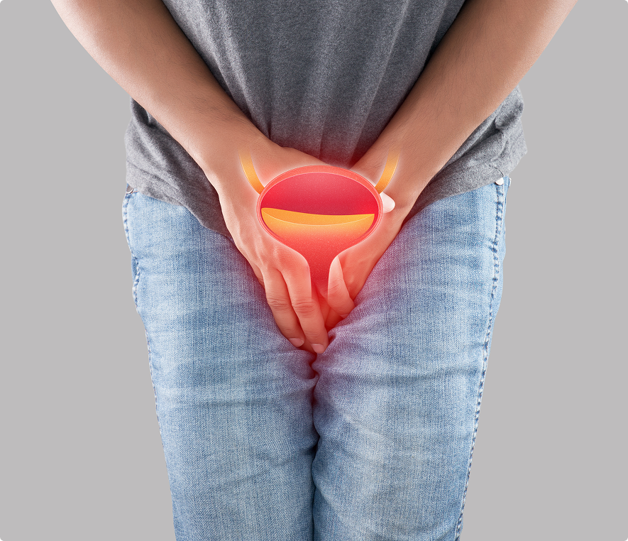 Human bladder health issue visual