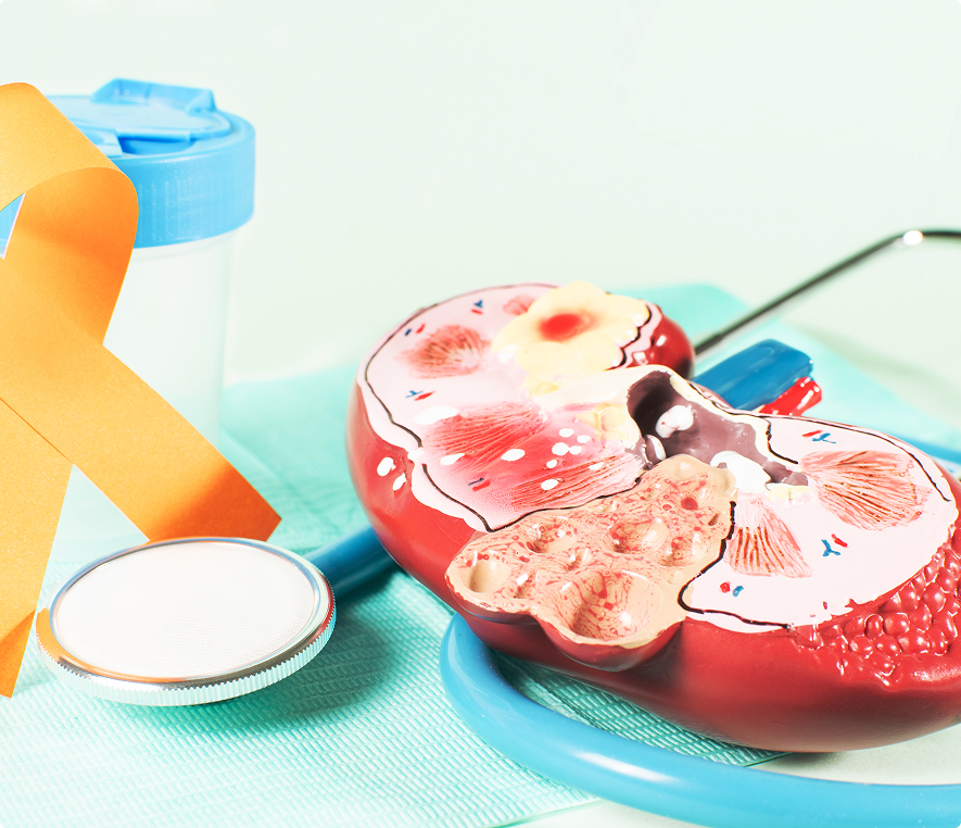 Kidney model with medical supplies