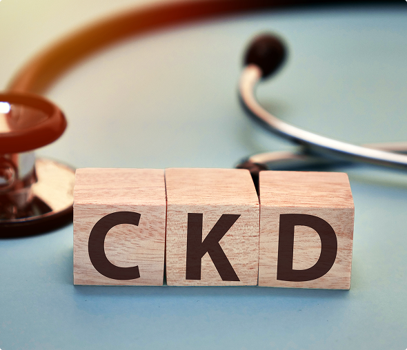 Wooden blocks spelling CKD
